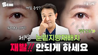 [무.물] 제발~ 눈밑지방재배치.. 재발! 안되게 하세요｜1%성형외과1%성형외과  #김종구 #눈밑지방재배치 #일퍼센트성형외과