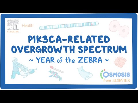 Achalasia Year of the Zebra