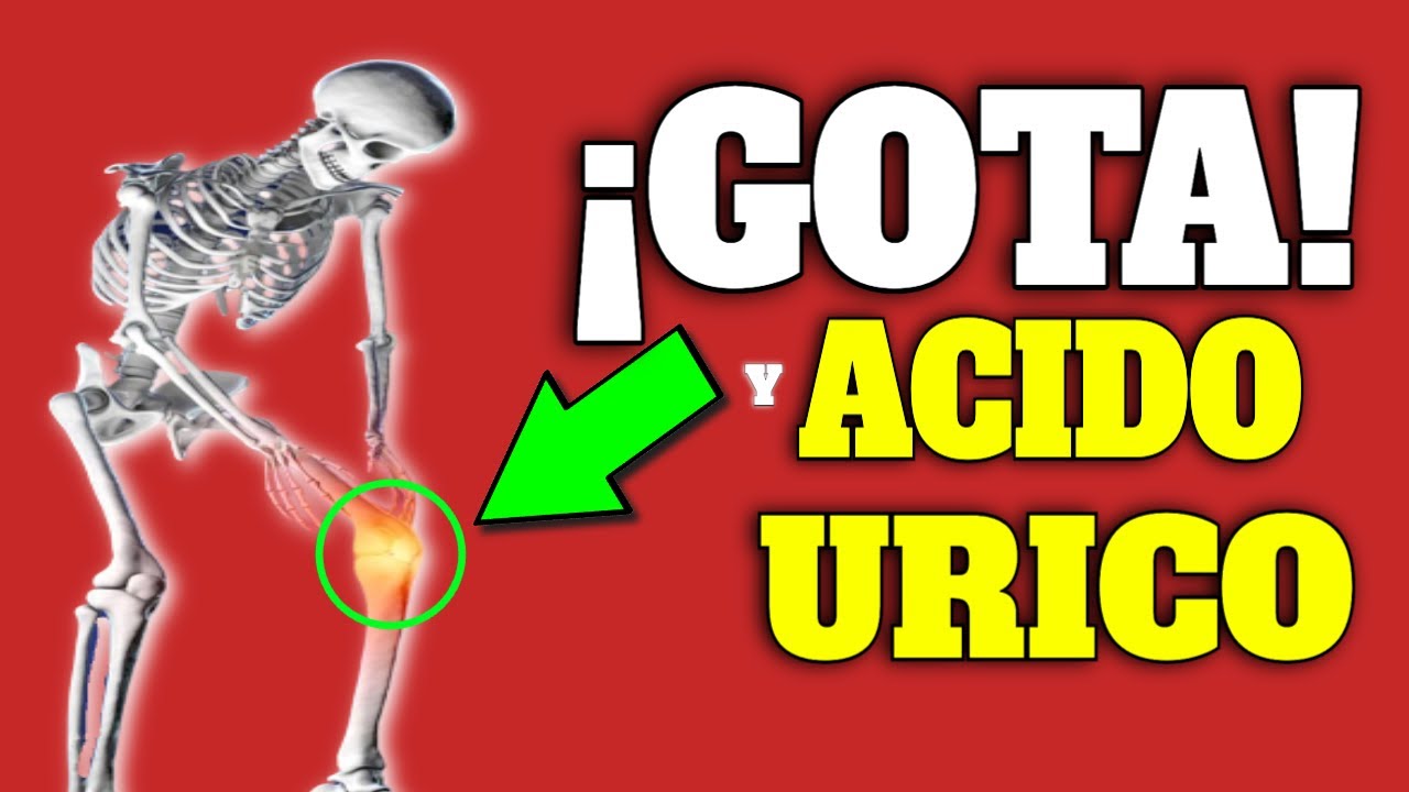 Watch SECRETOS para el ÁCIDO ÚRICO y la GOTA Now SECRETOS para el ÁCIDO ÚRICO y la GOTA