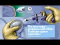 The 2 Major Problems with TESA (Testicular Sperm Aspiration) #drmalpani #malpaninifertilityclinic
