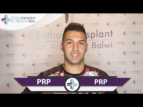 Nach der Zweiten Haarverpflanzung PRP Behandlung | PRP Therapie bei Elithairtransplant