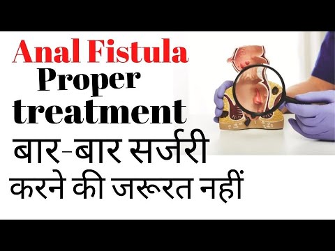 Laser surgery for piles fissure and fistula Laser treatment for piles fissure and fistula benefit