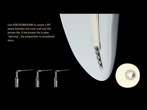 TFRK File Removal Kit by Woodpecker