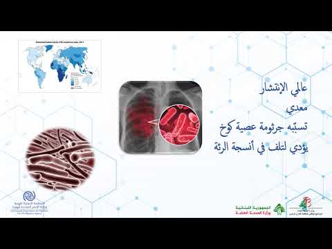 Video 1