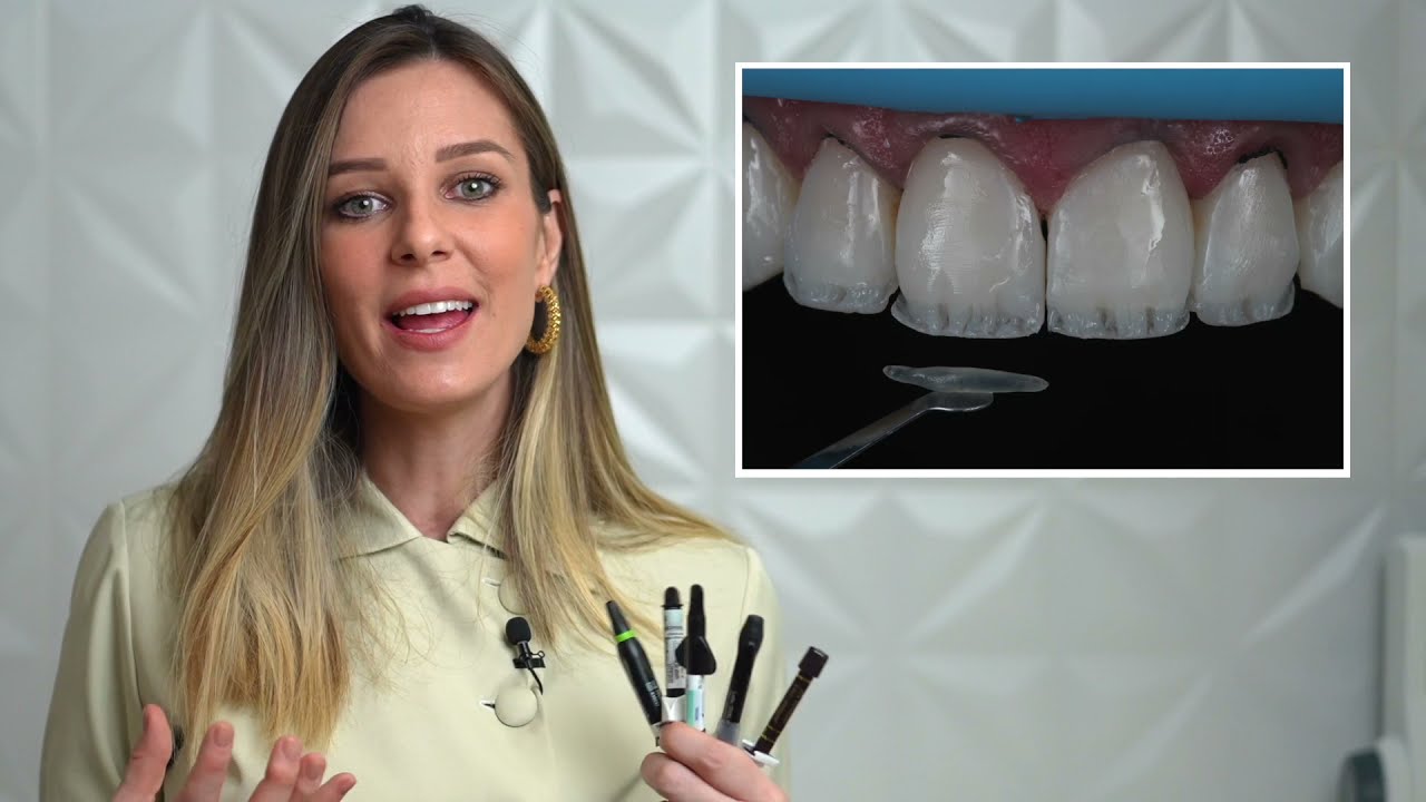 Como montar seu KIT DE RESINA COMPOSTA