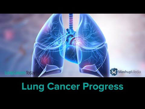 Dr. Gadgeel Reflects on Progress in Lung Cancer at IASLC 2024 World Conference on Lung Cancer