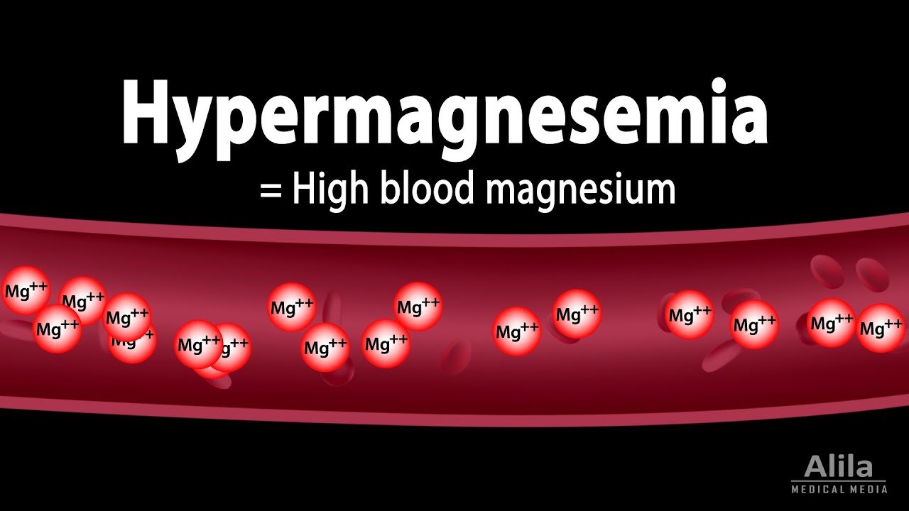 Hypermagnesemia: Causes, Pathophysiology, Symptoms, Diagnosis and Treatment, Animation. - YouTube