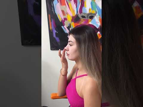 4 Years After Rhinoplasty: Strong and Flexible...   #rhinoplasty