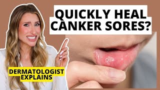 Dermatologist Explains Canker Sores: How to Prevent & Heal Them Faster | Dr. Sam Ellis