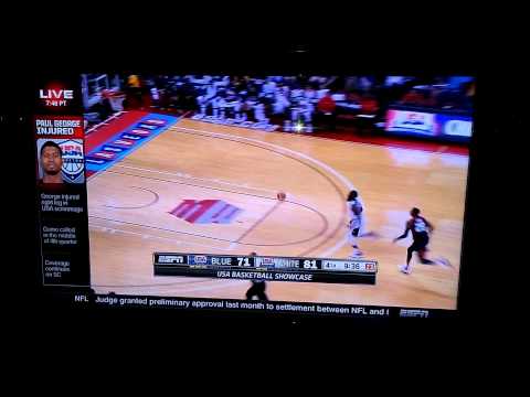 Paul George snaps leg