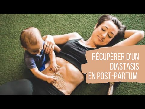 Récupérer d'un diastasis en post-partum