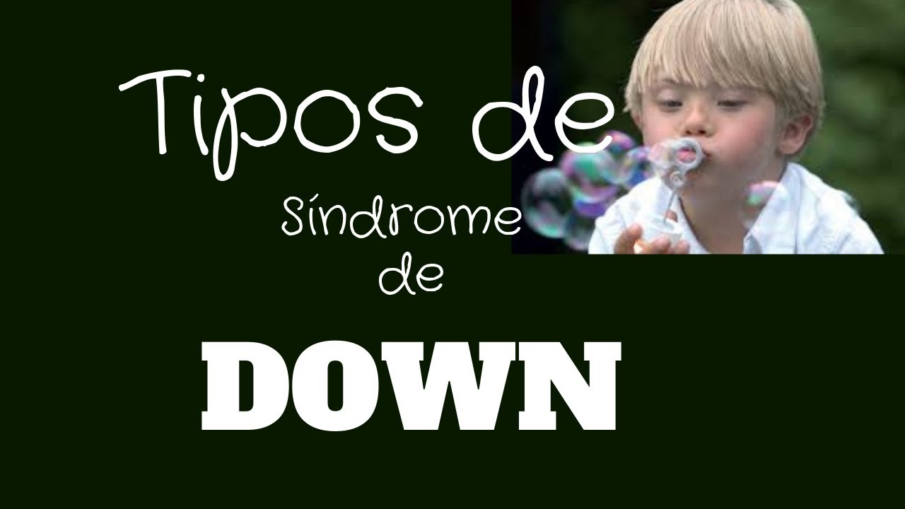 Tipos de síndrome de Down