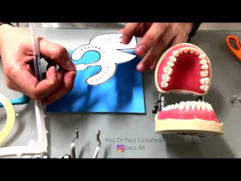 Aislamiento dental con PacDam