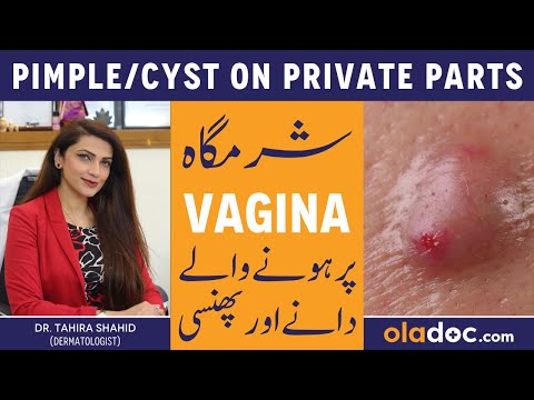 PIMPLE ON PRIVATE PARTS - Sharamgah Par Danay Ka Ilaj - Vaginal Cyst - Prevent Inner Thigh Pimples
