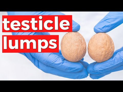 TESTICULAR CANCER - Why you should check your testicles for lumps