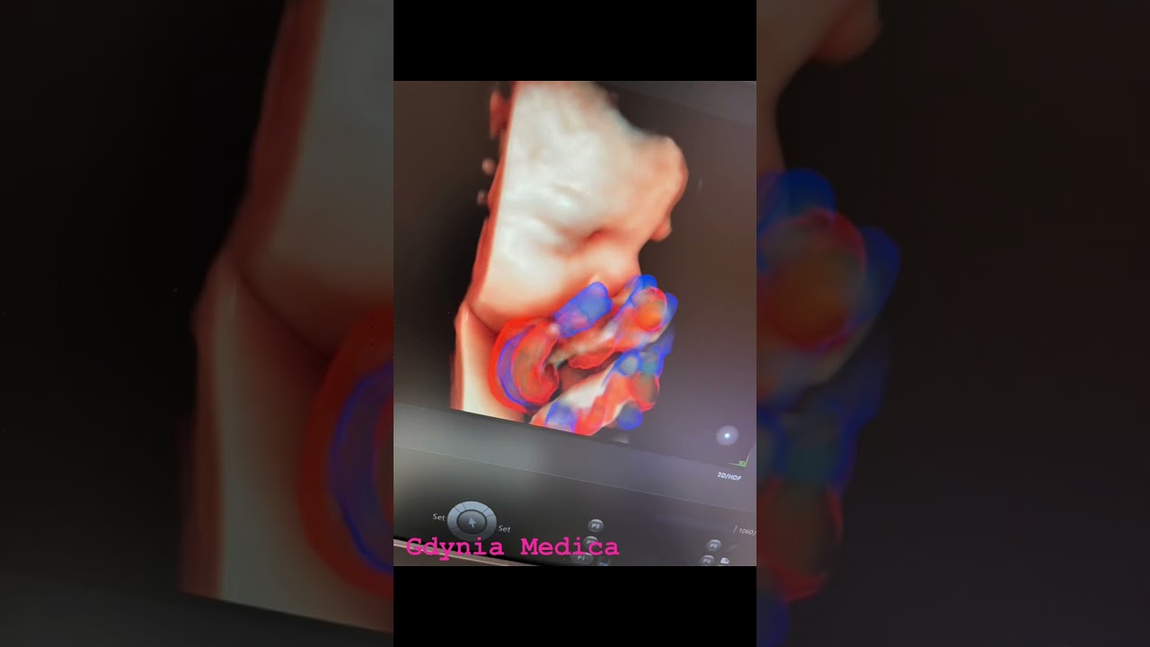 Katarzyna Leszczyńska-20