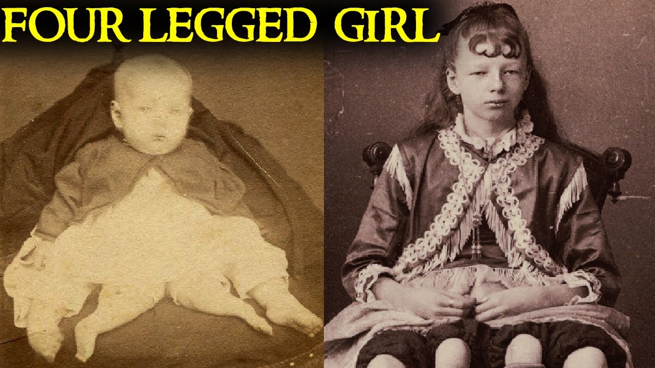 The Shocking True Story of the 