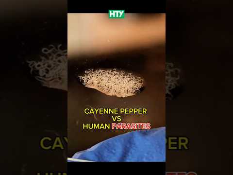Cayenne Pepper vs. Parasitic Worms – You Won’t Believe This! 🍍🧬
