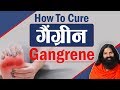 How To Cure Gangrene गैंग्रीन Swami Ramdev