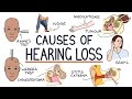 Understanding The Causes Of Hearing Loss