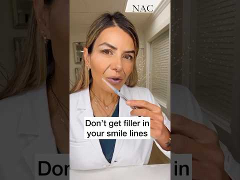 Don’t get filler in your smile lines #drbitafarrell #fillers #beauty