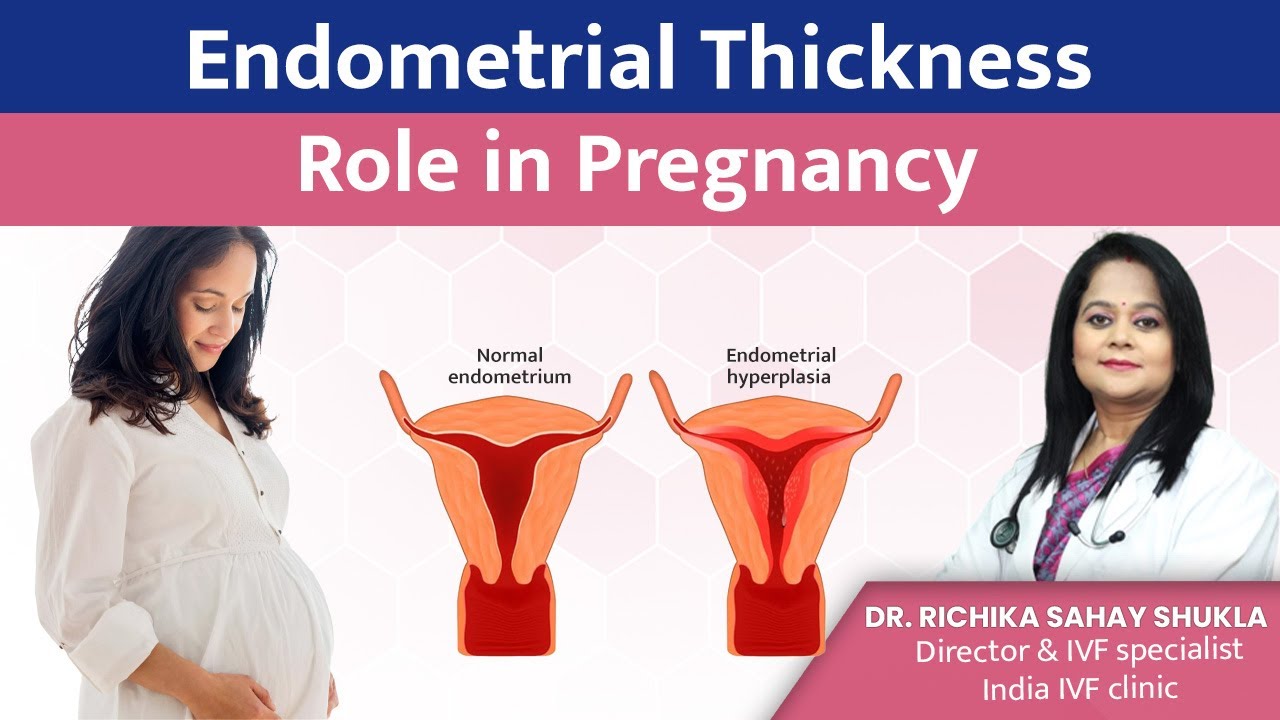 Watch video Endometrial Thickness Role in Pregnancy - Dr Richika Sahay Shukla Now Endometrial Thickness Role in Pregnancy - Dr Richika Sahay Shukla