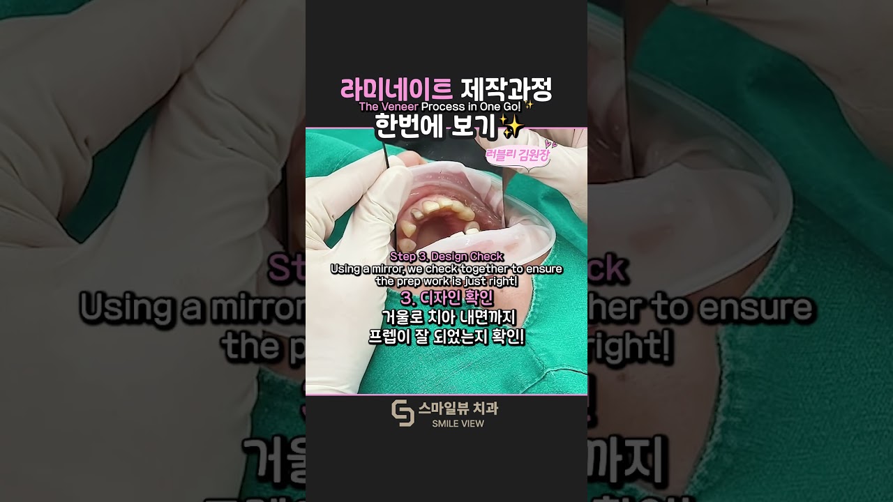 一次看懂瓷貼片的製作流程