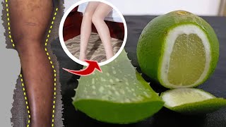 HOW MY LEG SCARS LIGHTEN FAST USING REMEDIES WITH ALOE VERA LEAVES,SCAR,MOSQUITO, BITES ON LEGS
