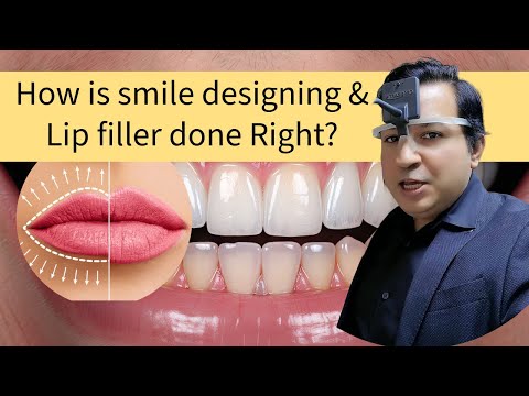 How do you take good lip fillers and Smile Design pictures? — Dubai healthcare video by Spectronix Consultancy
