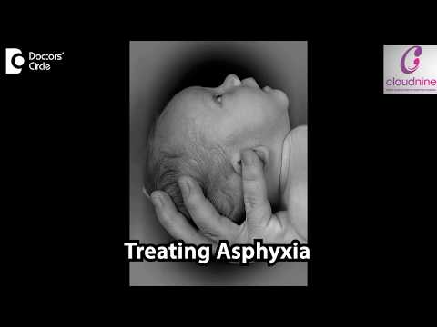 How do you treat Birth Asphyxia? - Dr. Piyush Shah of Cloudnine Hospitals | Doctors’ Circle