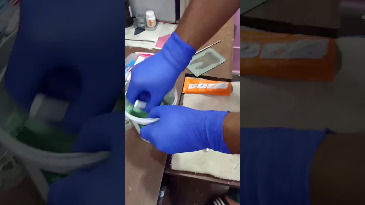 Utiliser le Zetaplus Putty Zhermack