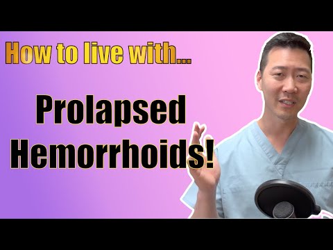 How to live with prolapsed hemorrhoids. It is possible.