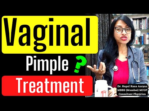 21yr ko VAGINA par PIMPLE ho gaya hai - VAGINAL PIMPLE ka TREATMENT , PREVENTION & CAUSE - Dr Rupal