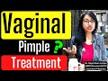 21yr Ko VAGINA Par PIMPLE Ho Gaya Hai VAGINAL PIMPLE Ka TREATMENT PREVENTION CAUSE Dr Rupal