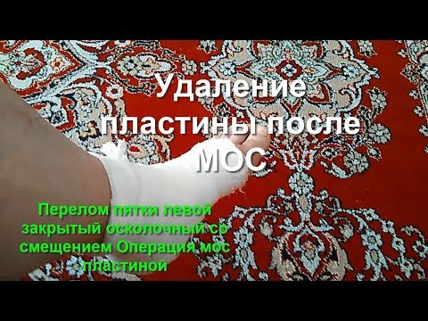 Тошнота и боль в шее у ребенка Гиалуроновая кислота в коленные суставы ее действие