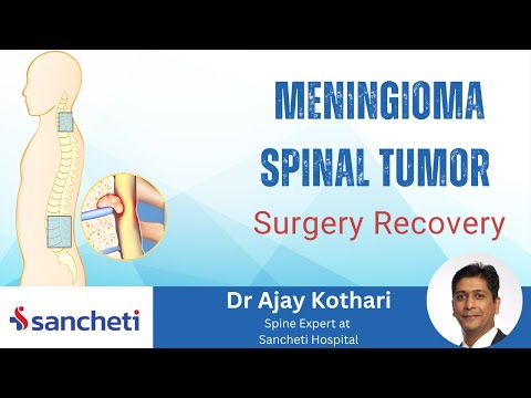 Meningioma Spinal Tumor Surgery Recovery Explained by Dr. Ajay Kothari 