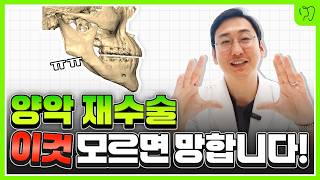 양악수술 재수술 안하려면 필수시청 양악재수술 이렇게 해야 또 안합니다‼️