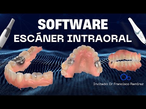 Software del escáner intraoral