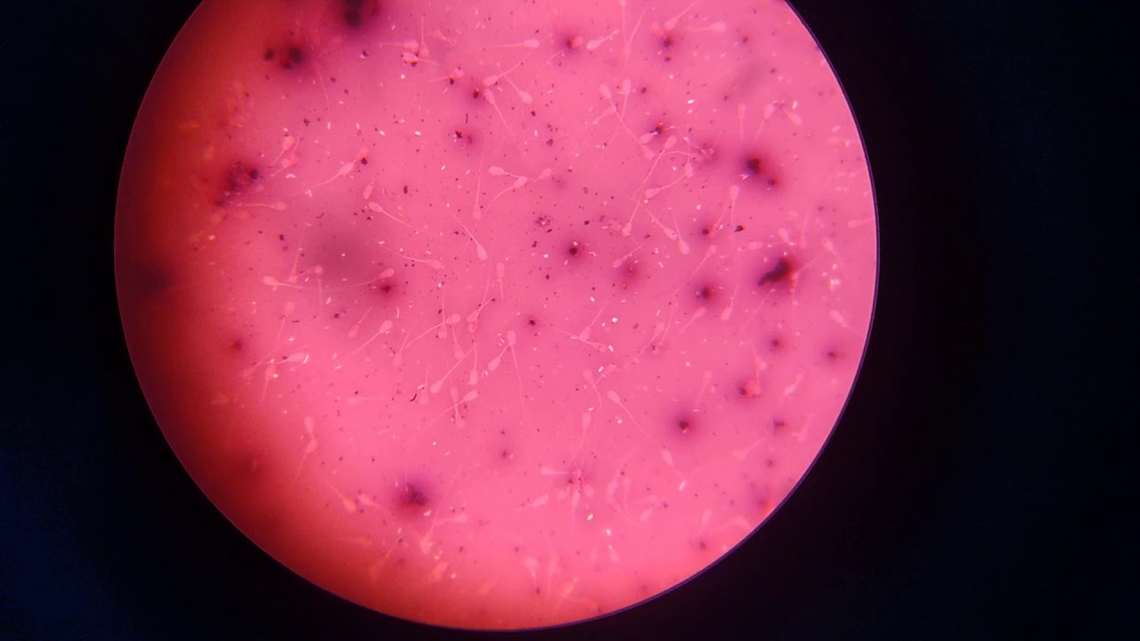 ANÁLISIS MICROSCÓPICO DE SEMEN DESCONGELADO