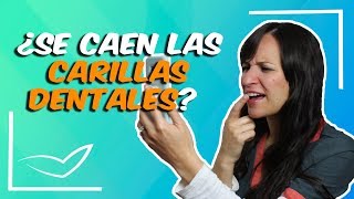 Se me cayo una carilla dental l ¿Las carillas dentales se caen