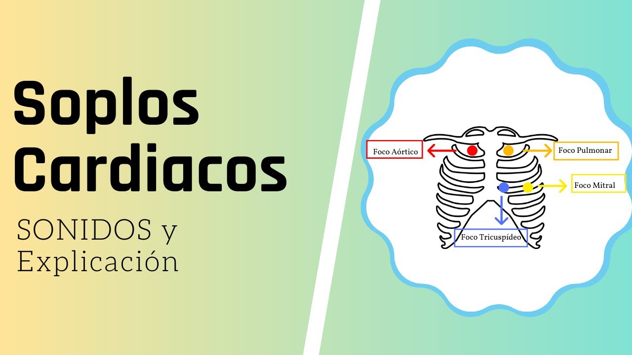 Soplos Cardiacos - SONIDOS y explicación 🔉 | Fiebre Medica