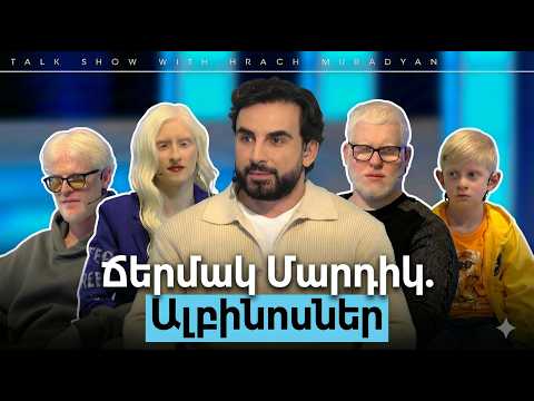 Ճերմակ Մարդիկ. Ալբինոսներ / Բաց Թեմա