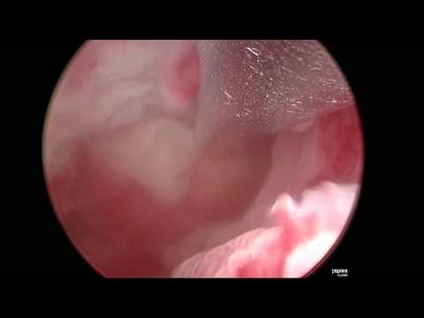 download lagu mp3 mp4 Buy Mifekit Online, download lagu Buy Mifekit Online gratis, unduh video klip Buy Mifekit Online