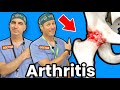 Treating Hip Arthritis Without Surgery