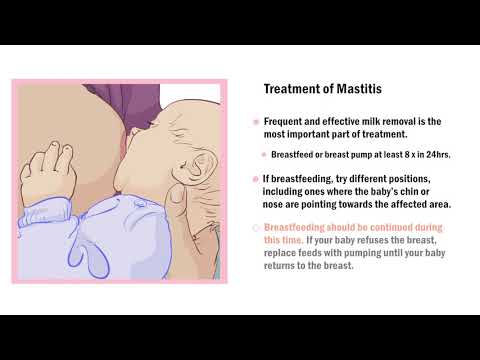 Common Breast Complications during Lactation