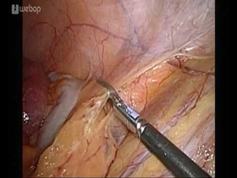 Als Prostatitis bei Männern in der Home-Video-Umgebung zu behandeln Behandlung von Prostatitis Trichopolum