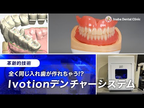 革新的技術！！ 全く同じ入れ歯が作れちゃう！？ Ivotionデンチャーシステム