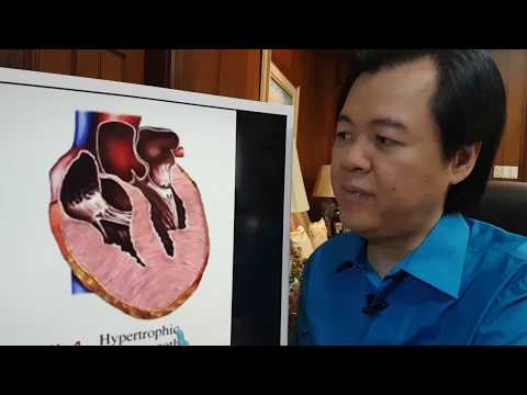 Bumili ng isang barnisan laban kuko halamang-singaw sa aking mga paa Cream kuko halamang-singaw upang alisin ang mga kuko