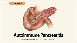 Download Lagu Linear EUS: Autoimmune Pancreatitis Thumbnail