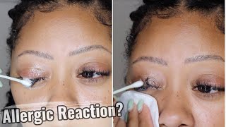TAKING MY LASH EXTENSIONS OFF AFTER AN ALLERGIC REACTION!